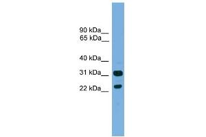 WB Suggested Anti-CD8B Antibody Titration:  0. (CD8B Antikörper  (Middle Region))