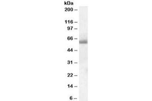 Western blot testing of human tonsil lysate with SH2D3A antibody at 0. (SH2D3A Antikörper)