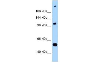WB Suggested Anti-L1CAM Antibody Titration: 1. (L1CAM Antikörper  (C-Term))