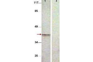 Aurora Kinase B Antikörper  (pThr232)