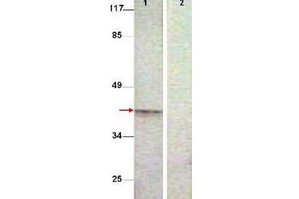 Aurora Kinase B Antikörper  (pThr232)