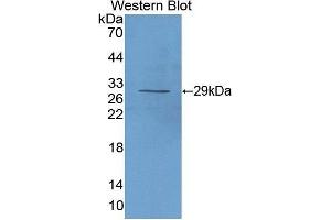 Western Blotting (WB) image for anti-Interleukin 2 Receptor, alpha (IL2RA) (AA 22-243) antibody (ABIN3205980) (CD25 Antikörper  (AA 22-243))
