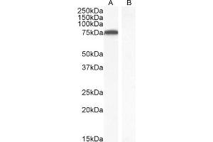 Western Blotting (WB) image for anti-IL2-Inducible T-Cell Kinase (ITK) (C-Term) antibody (ABIN184605)