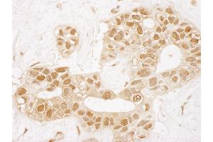 Immunohistochemistry (IHC) image for anti-TP53 induced glycolysis regulatory phosphatase (TIGAR) (AA 220-270) antibody (ABIN7448835) (TIGAR Antikörper  (AA 220-270))