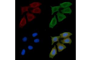 ABIN6261444 and ABIN6277566 staining Hela cells(45 min of heat-shock) by IF/ICC. (EEF2K Antikörper  (Internal Region))