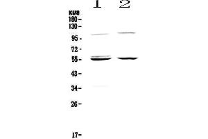 Western blot analysis of Caspase 8 using anti-Caspase 8 antibody . (Caspase 8 Antikörper  (AA 389-479))