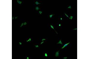 Immunofluorescence staining of SH-SY5Y cells with ABIN7161274 at 1:100, counter-stained with DAPI. (NEFH Antikörper  (AA 825-1003))