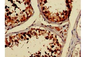 Immunohistochemistry of paraffin-embedded human testis tissue using ABIN7173663 at dilution of 1:100 (TUBA3C Antikörper  (AA 161-418))