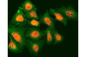 IF analysis of TMOD2 and Tubulin beta using anti-TMOD2 antibody (ABIN7599739) and anti-Tubulin beta antibody (ABIN7602744). (TMOD2 Antikörper  (AA 111-343))
