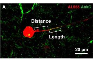 Representative image of Alexa 555 (AL555, red) dye-filled RGC labeled for the axon initial segment (AIS) scaffolding protein ankyrin-G (AnkG, cat. (Ankyrin G Antikörper)