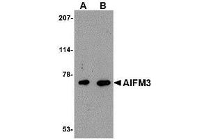 Western blot analysis of AIFM3 in human brain tissue lysate with AIFM3 antibody at (A) 1 and (B) 2 µg/ml.