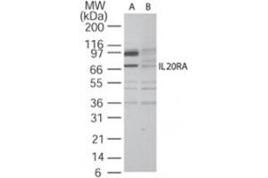 Western blot analysis of IL20RA in A-375 cell lysate in the (A) absence and (B) presence of blocking peptide using IL20RA polyclonal antibody  at 2 ug/mL . (IL20RA Antikörper  (AA 159-175))