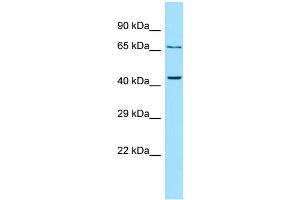 WB Suggested Anti-PTH2R Antibody Titration: 1. (PTH2R Antikörper  (C-Term))
