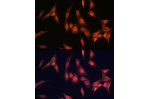 Immunofluorescence analysis of NIH/3T3 cells using P antibody (ABIN7269146) at dilution of 1:100. (PAK2 Antikörper)