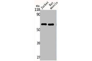 Western Blot analysis of Jurkat RAT-MUSCLE cells using CYP4Z1/2 Polyclonal Antibody (CYP4Z2P Antikörper  (Internal Region))
