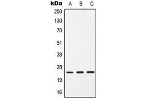 Western blot analysis of CD9 expression in HepG2 (A), SP2/0 (B), H9C2 (C) whole cell lysates. (CD9 Antikörper  (Center))