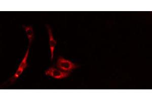 ABIN6274616 staining HepG2 cells by IF/ICC. (CDCA3 Antikörper  (C-Term))