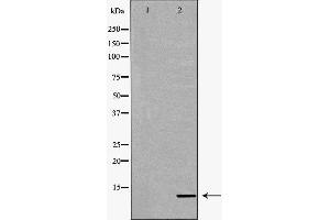 Western blot analysis of extracts of mouse kidney, using CYCS antibody. (Cytochrome C Antikörper  (N-Term))