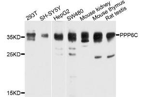 Western blot analysis of extracts of various cells, using PPP6C antibody.
