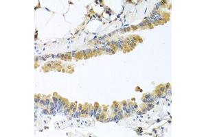 Immunohistochemistry of paraffin-embedded mouse lung using CPA1 antibody. (CPA1 Antikörper)