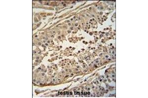 Immunohistochemistry (Paraffin-embedded Sections) (IHC (p)) image for anti-F-Box Protein 24 (FBXO24) (AA 118-145) antibody (ABIN654961)