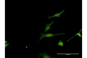 Immunofluorescence of purified MaxPab antibody to FAM117A on HeLa cell. (FAM117A Antikörper  (AA 1-453))