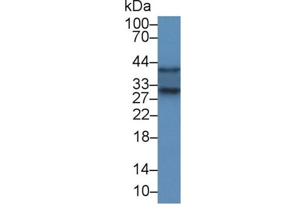 SOD3 抗体  (AA 16-244)