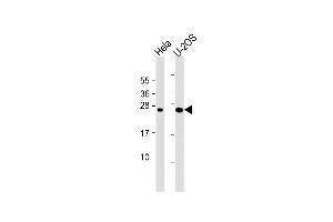 All lanes : Anti-DCTN6 Antibody (Center) at 1:1000 dilution Lane 1: Hela whole cell lysate Lane 2: U-2OS whole cell lysate Lysates/proteins at 20 μg per lane. (DCTN6 Antikörper  (AA 53-80))