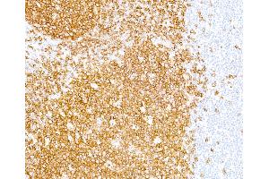 Immunohistochemistry (IHC) image for anti-Membrane-Spanning 4-Domains, Subfamily A, Member 1 (MS4A1) antibody (ABIN7449560) (CD20 Antikörper)