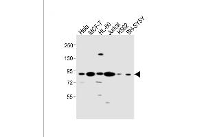 All lanes : Anti-CCNT1 Antibody (Center) at 1:1000 dilution Lane 1: Hela whole cell lysate Lane 2: MCF-7 whole cell lysate Lane 3: HL-60 whole cell lysate Lane 4: Jurkat whole cell lysate Lane 5: K562 whole cell lysate Lane 6: SH-SY5Y whole cell lysate Lysates/proteins at 20 μg per lane. (Cyclin T1 Antikörper  (AA 253-281))