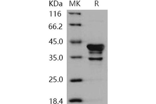 CAMK1 Protein