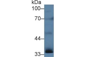 Detection of INHa in Rat Testis lysate using Polyclonal Antibody to Inhibin Alpha (INHa) (Inhibin alpha Antikörper  (AA 25-363))