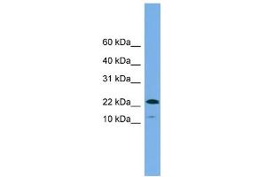 WB Suggested Anti-WFDC1 Antibody Titration: 0. (WFDC1 Antikörper  (N-Term))