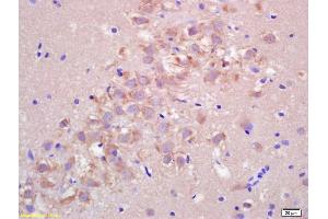 Formalin-fixed and paraffin embedded rat brain labeled with Rabbit Anti FIS1/TTC11 Polyclonal Antibody, Unconjugated (ABIN872461) at 1:200 followed by conjugation to the secondary antibody and DAB staining (Fission 1 Antikörper  (AA 55-152))