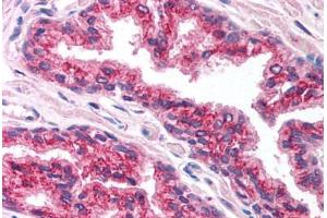 Human Prostate (formalin-fixed, paraffin-embedded) stained with FOXA1 antibody ABIN214751 at 5 ug/ml followed by biotinylated goat anti-rabbit IgG secondary antibody ABIN481713, alkaline phosphatase-streptavidin and chromogen. (FOXA1 Antikörper  (AA 395-444))