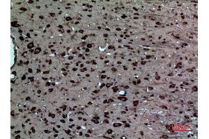 Immunohistochemistry (IHC) analysis of paraffin-embedded Rat Brain, antibody was diluted at 1:100.