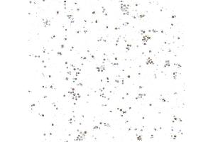 Immunocytochemistry (ICC) image for anti-N-Myc Proto-Oncogene Protein (MYCN) (AA 100-150) antibody (ABIN7795786)