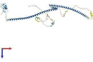 TRAIP Protein (AA 1-469) (His tag)