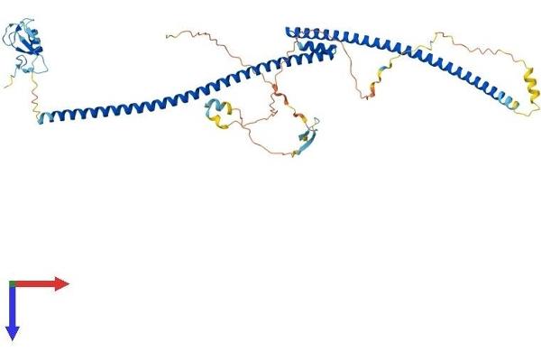 TRAIP Protein (AA 1-469) (His tag)