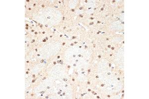 Immunohistochemistry (IHC) image for anti-Proteasome Subunit alpha 2 (PSMA2) antibody (ABIN7269597)