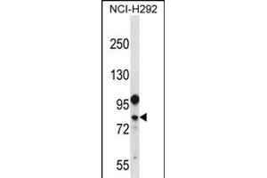 DDX3Y Antibody (N-term) (ABIN656714 and ABIN2845943) western blot analysis in NCI- cell line lysates (35 μg/lane). (DDX3Y Antikörper  (N-Term))