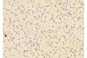 ABIN6261671 and ABIN6273116 at 1/100 staining Rat brain tissue by IHC-P.