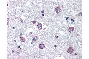Anti-NPC1 antibody IHC of human brain, cortex. (NPC1 Antikörper)