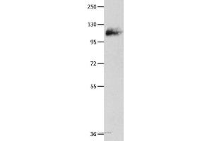 Western blot analysis of Mouse lung tissue, using AMPH Polyclonal Antibody at dilution of 1:500 (Amphiphysin Antikörper)
