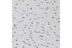 Immunohistochemistry of paraffin-embedded rat brain using PRPF3 Antibody (ABIN1876670) at dilution of 1:100 (40x lens). (PRPF3 Antikörper)