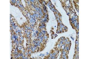 Immunohistochemistry (Paraffin-embedded Sections) (IHC (p)) image for anti-Mitochondrial Ribosomal Protein L28 (MRPL28) antibody (ABIN7261852)
