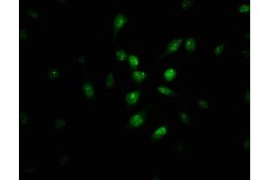 Immunofluorescence staining of U251 cells with ABIN7163461 at 1:100, counter-stained with DAPI. (Pirin Antikörper  (AA 1-290))