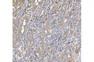 IHC analysis of SND1 using anti-SND1 antibody (ABIN7600526). (SND1 Antikörper  (AA 20-204))