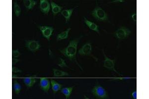 Immunofluorescence analysis of L929 cells using SRPRB Polyclonal Antibody at dilution of 1:100. (SRPRB Antikörper)