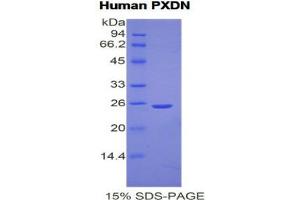 SDS-PAGE (SDS) image for Peroxidasin Homolog (PXDN) (AA 76-260) protein (His tag) (ABIN1877678)